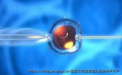 做第三代试管婴儿的条件严不严