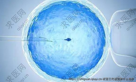 试管三代都需要什么条件