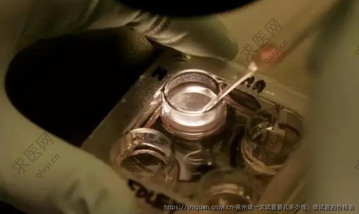 常州做一次试管婴儿多少钱，做试管的价格表