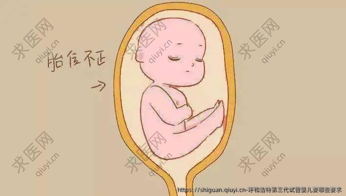 呼和浩特第三代试管婴儿要哪些要求