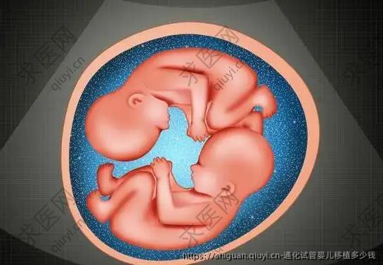 通化试管婴儿移植多少钱