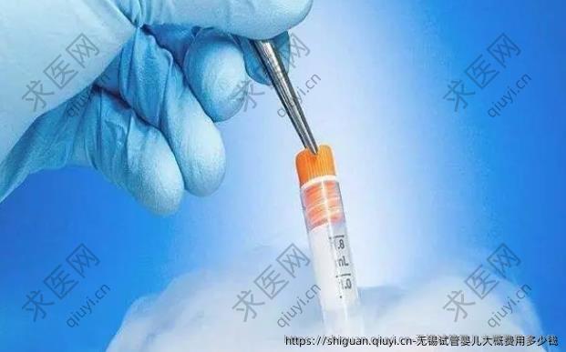 无锡试管婴儿大概费用多少钱