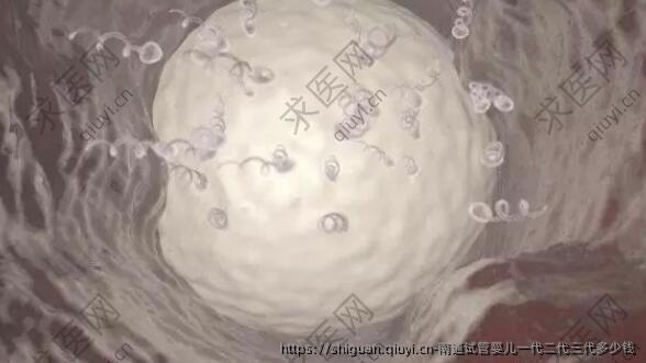 南通试管婴儿一代二代三代多少钱