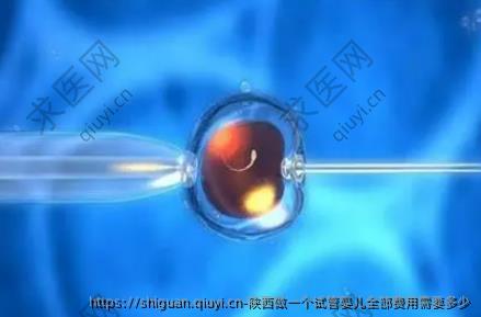 陕西做一个试管婴儿全部费用需要多少