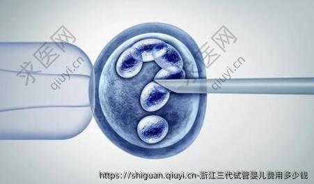 浙江三代试管婴儿费用多少钱