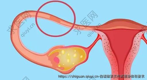 白城做第三代试管身体有要求