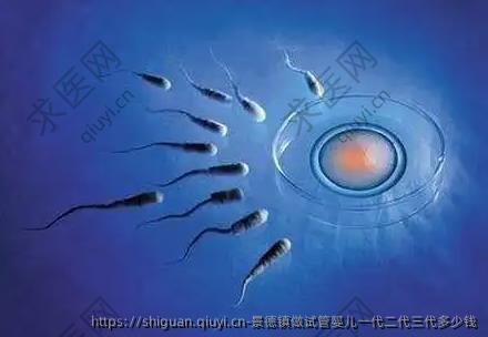 景德镇做试管婴儿一孕二孕三孕多少钱