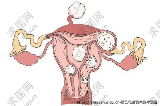 三：代试管六盘水医院