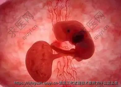 清远三代试管技术费用为什么这么贵