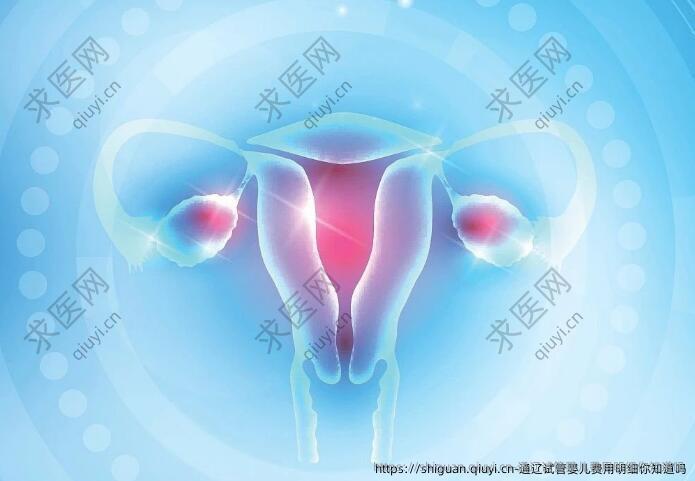 通辽试管婴儿费用明细你知道吗