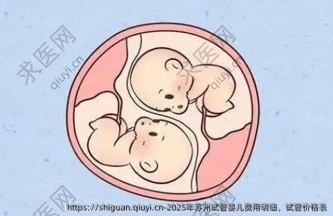 2025年苏州试管婴儿费用明细，试管价格表