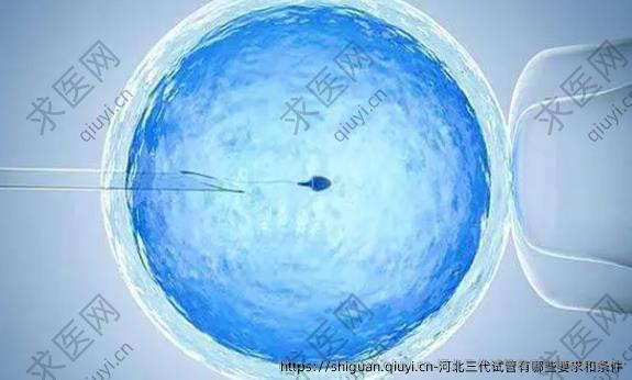 河北三代试管有哪些要求和条件