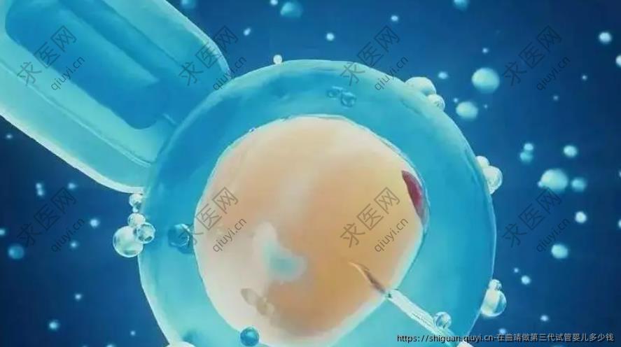 在曲靖做第三代试管婴儿多少钱