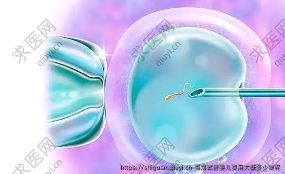 青海试管婴儿费用大概多少钱呢