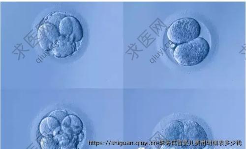 珠海试管婴儿费用明细表多少钱
