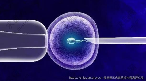 景德镇三孕试管机构哪家好点呢