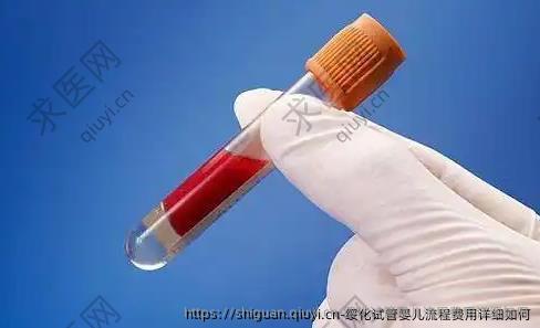 绥化试管婴儿流程费用详细如何