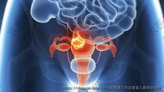 去鹤壁第三孕试管婴儿费用会涨吗