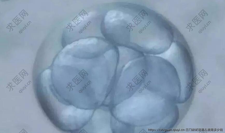三门峡试管婴儿费用多少钱
